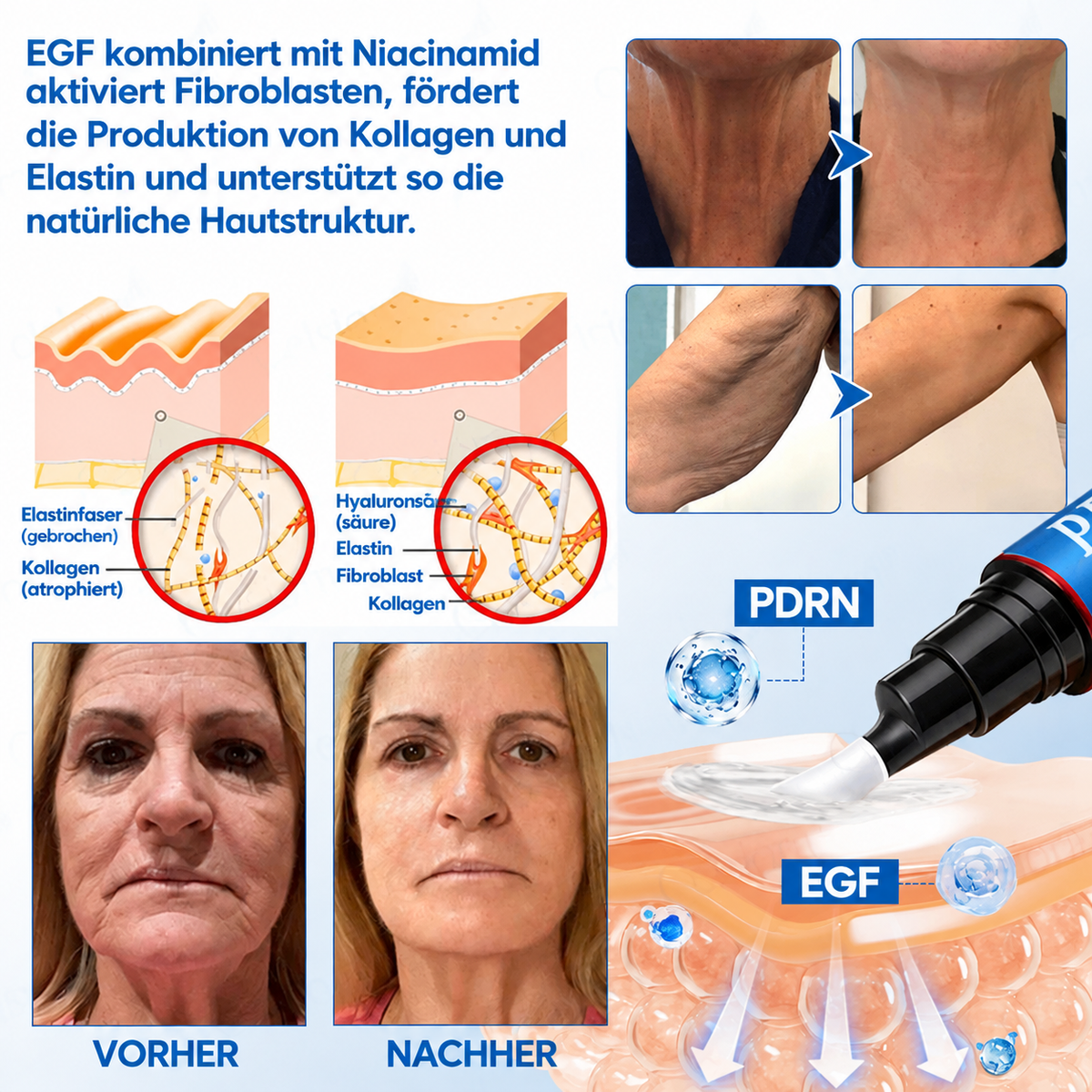Celsiora® Botox & PDRN Anti-Falten-Shot – Lifting- & Straffungscreme