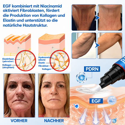 Celsiora® Botox & PDRN Anti-Falten-Shot – Lifting- & Straffungscreme