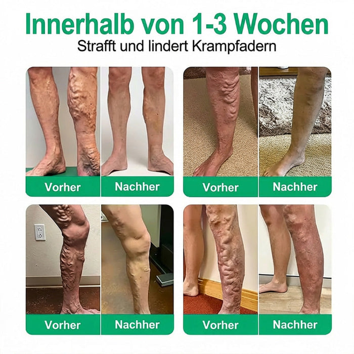 🇦🇹👨‍⚕️✅ Healrize® VeinTarget Mikronadel-Pflaster ⚡ Sofortige Linderung, langanhaltende Ergebnisse🎁🎁