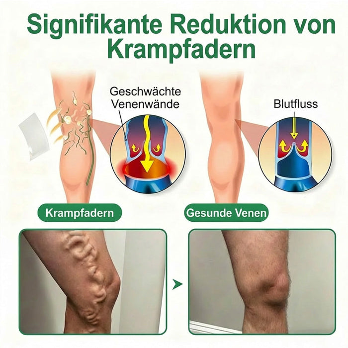 🇦🇹👨‍⚕️✅ Healrize® VeinTarget Mikronadel-Pflaster ⚡ Sofortige Linderung, langanhaltende Ergebnisse🎁🎁