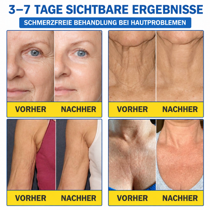 Celsiora® Botox & PDRN Anti-Falten-Shot – Lifting- & Straffungscreme