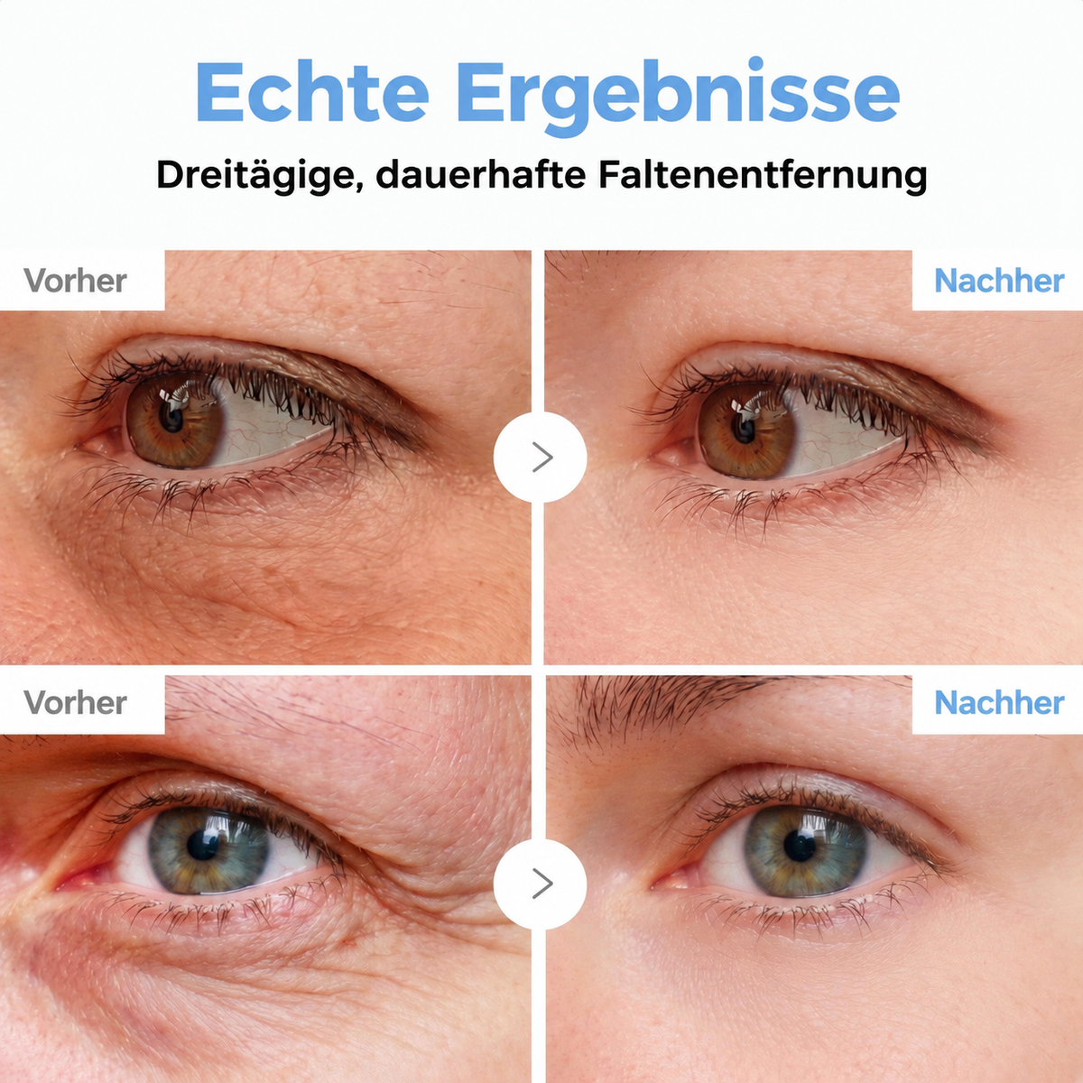 Celsiora® Botox & PDRN Anti-Falten-Shot – Lifting- & Straffungscreme