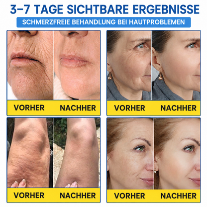 Celsiora® Botox & PDRN Anti-Falten-Shot – Lifting- & Straffungscreme