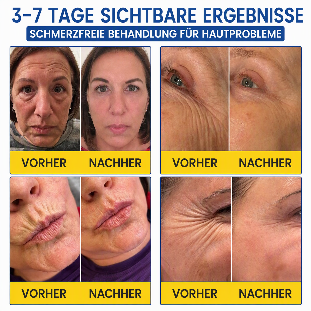 Celsiora® Botox & PDRN Anti-Falten-Shot – Lifting- & Straffungscreme