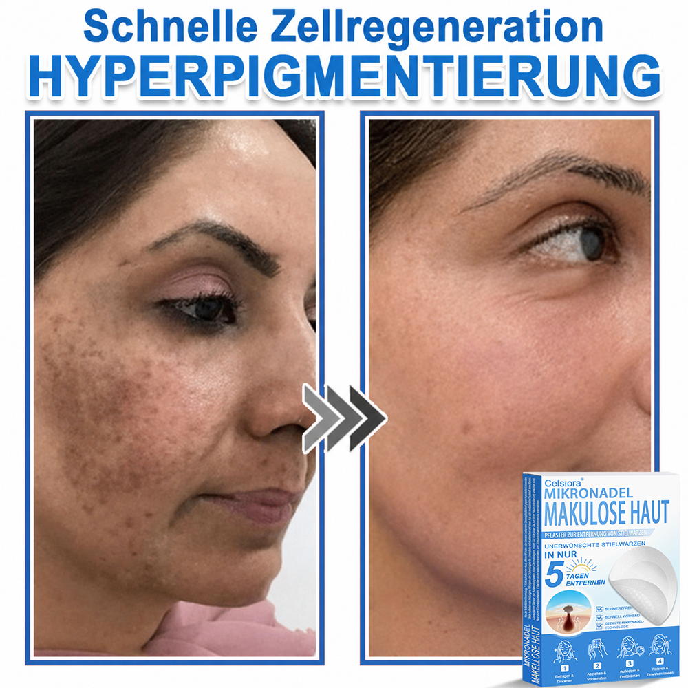 🏆Celsiora® 2-in-1 Mikronadel- & Hydrokolloid-Pflaster | Entferner für erhabene ✨✨
