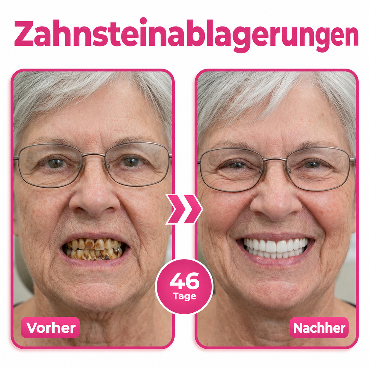 Natravor® Thismile NH-10 Zahnpasta-Serum zur Pflege von Zahnschmelz und Zahnfleisch – Fortschrittliche Therapie