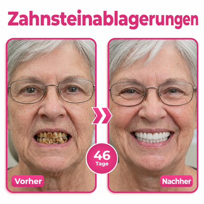 Natravor® Thismile NH-10 Zahnpasta-Serum zur Pflege von Zahnschmelz und Zahnfleisch – Fortschrittliche Therapie