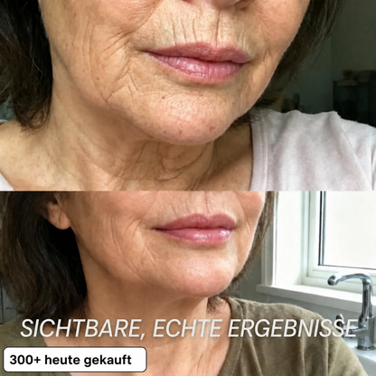 PDRN Bio-Kollagen-Stick mit aufpolsternder Wirkung🧡🧡