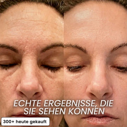 PDRN Bio-Kollagen-Stick mit aufpolsternder Wirkung