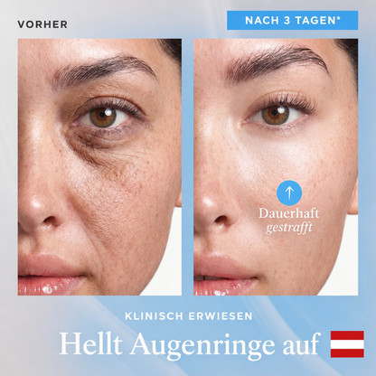 Celsiora® Botox & PDRN Anti-Falten-Shot – Lifting- & Straffungscreme